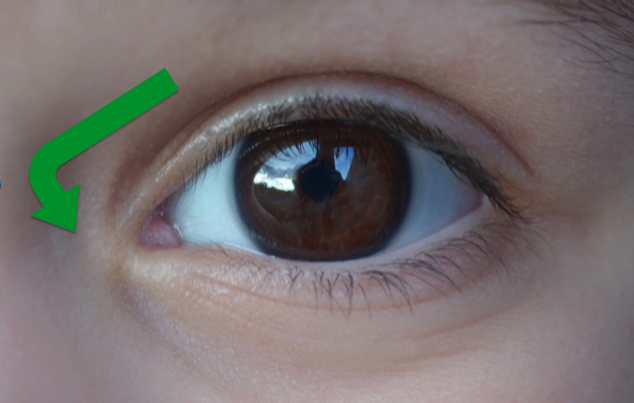 oog