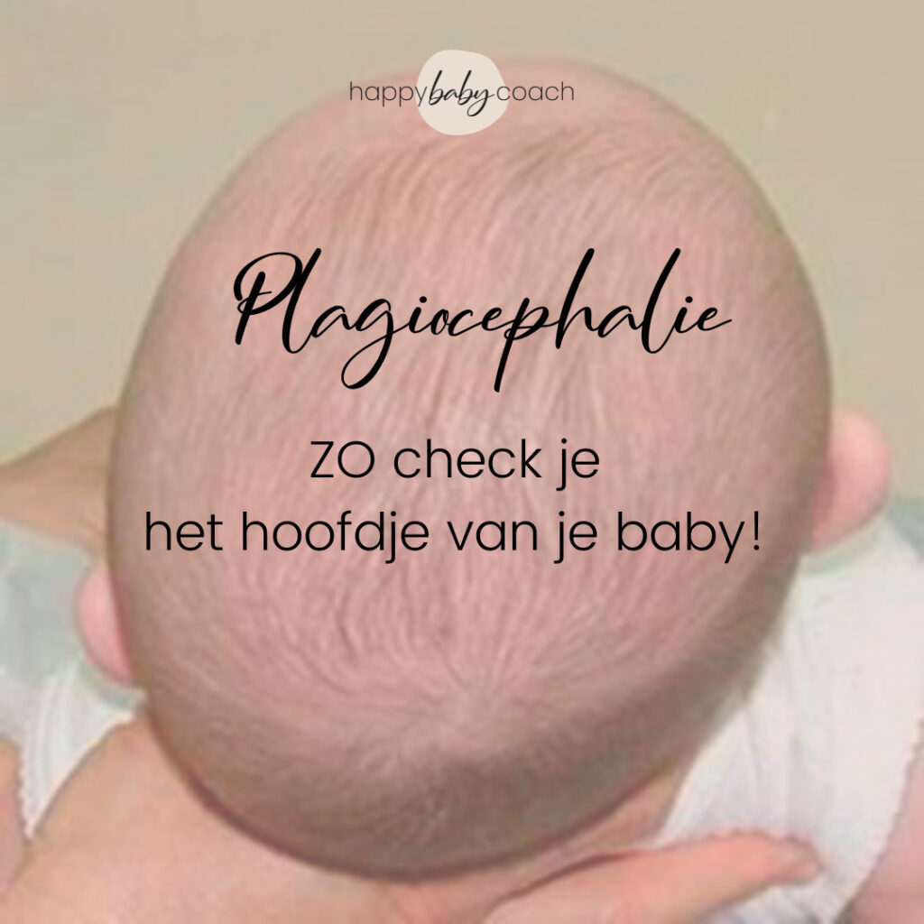 plat achterhoofd baby plat achterhoofd baby